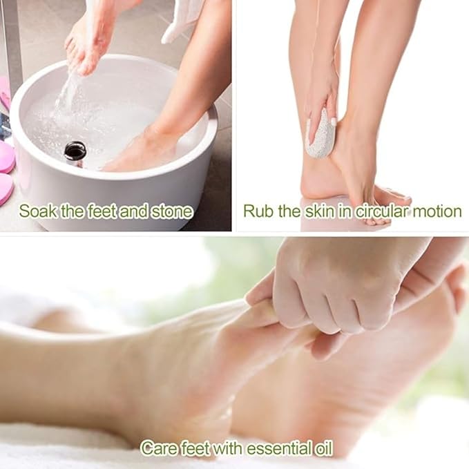 Natural Pumice Stone for Feet, Lava Pedicure Tools Hard Skin Callus Remover for Feet and Hands - Natural Foot File Exfoliation to Remove Dead Skin, Heels, Elbows, Hands (Pack of 1) - Flymaster Shop